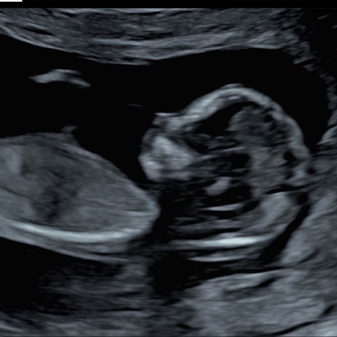 Photo shared by Maura for their Babylist baby registry.