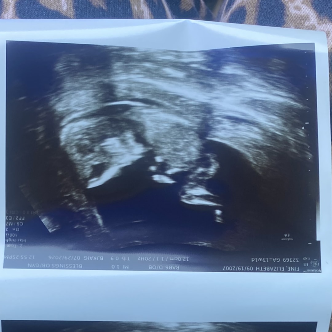 Photo shared by Elizabeth for their Babylist baby registry.