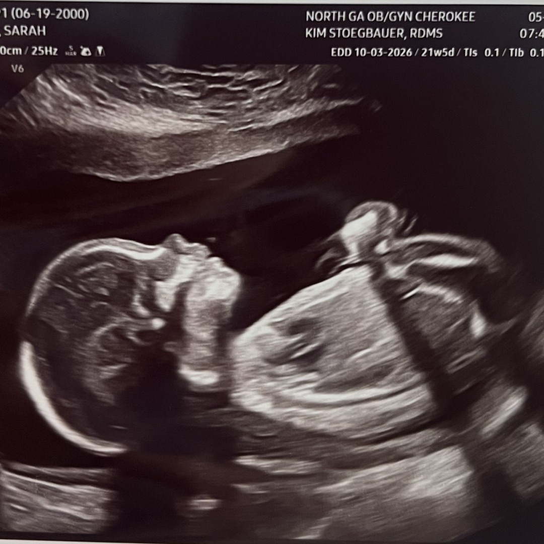 Photo shared by Johanna for their Babylist baby registry.