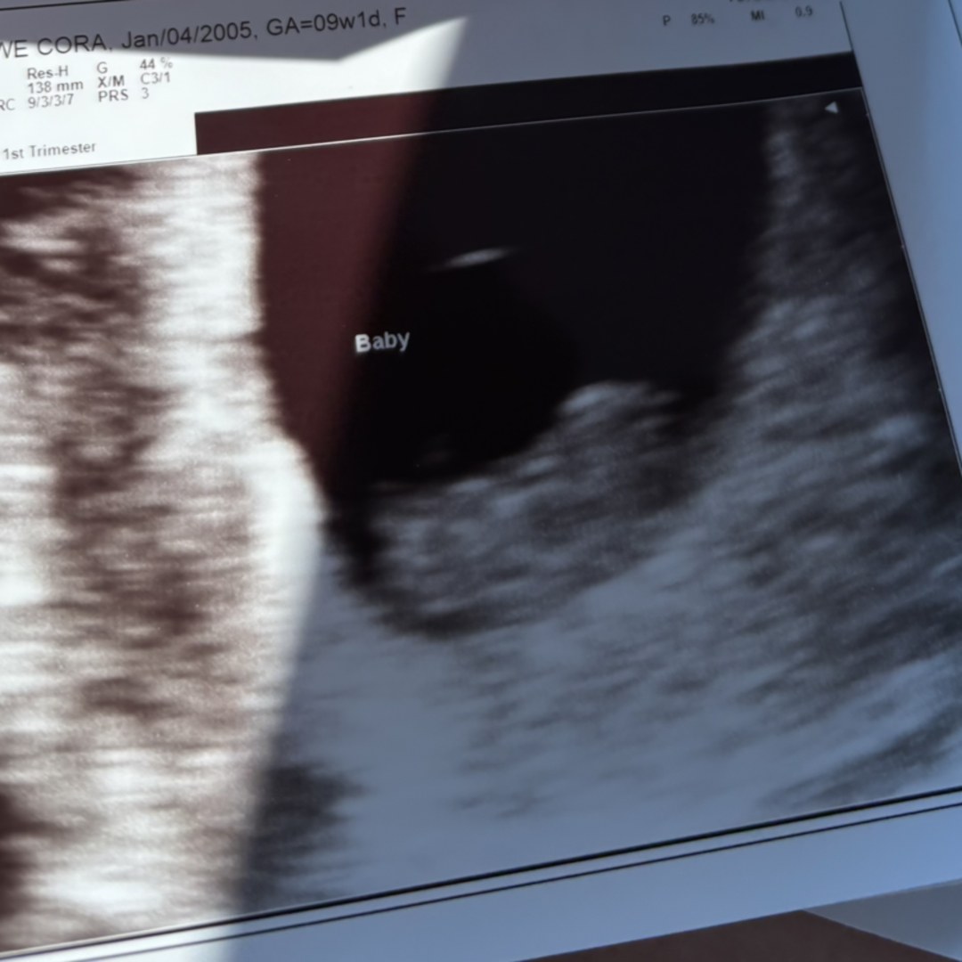 Photo shared by Cora for their Babylist baby registry.