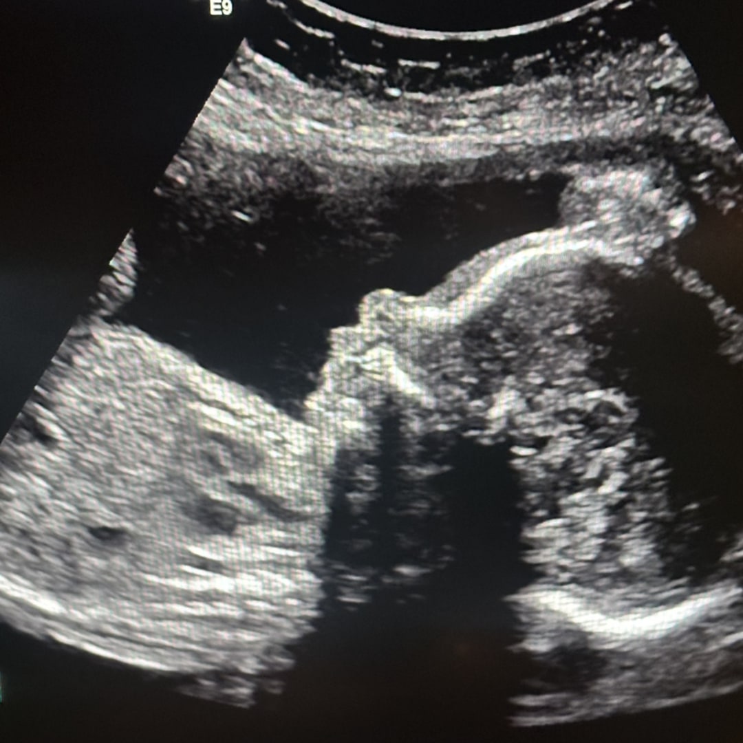Photo shared by Korianne for their Babylist baby registry.