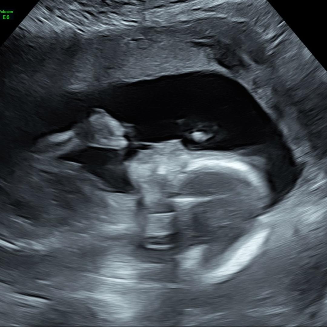 Photo shared by Cameron for their Babylist baby registry.