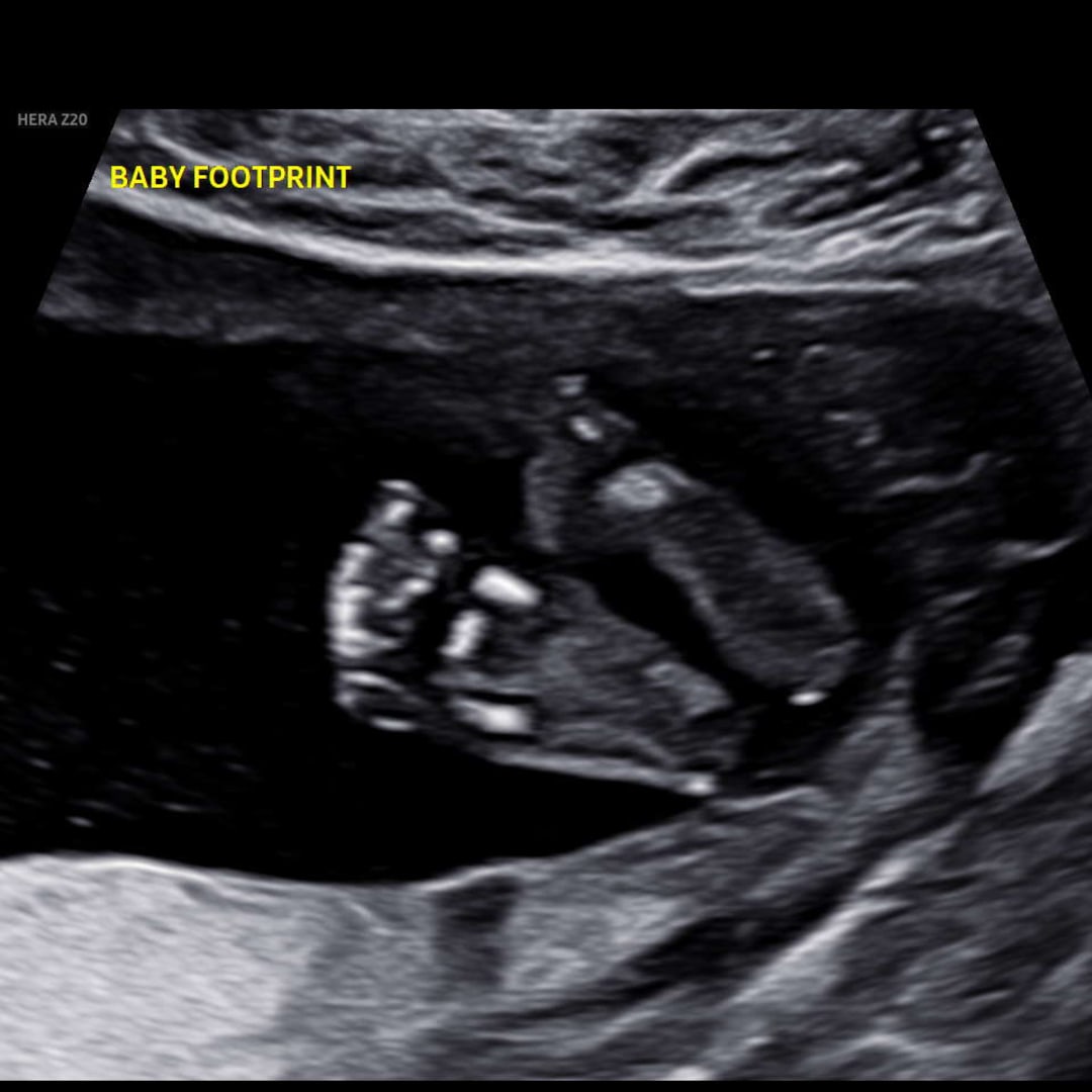 Photo shared by Shanise for their Babylist baby registry.