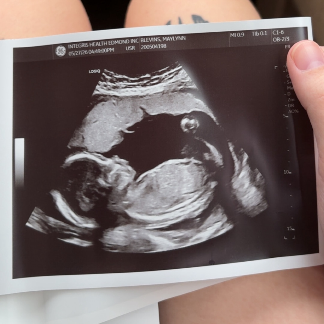 Photo shared by Maylynn for their Babylist baby registry.