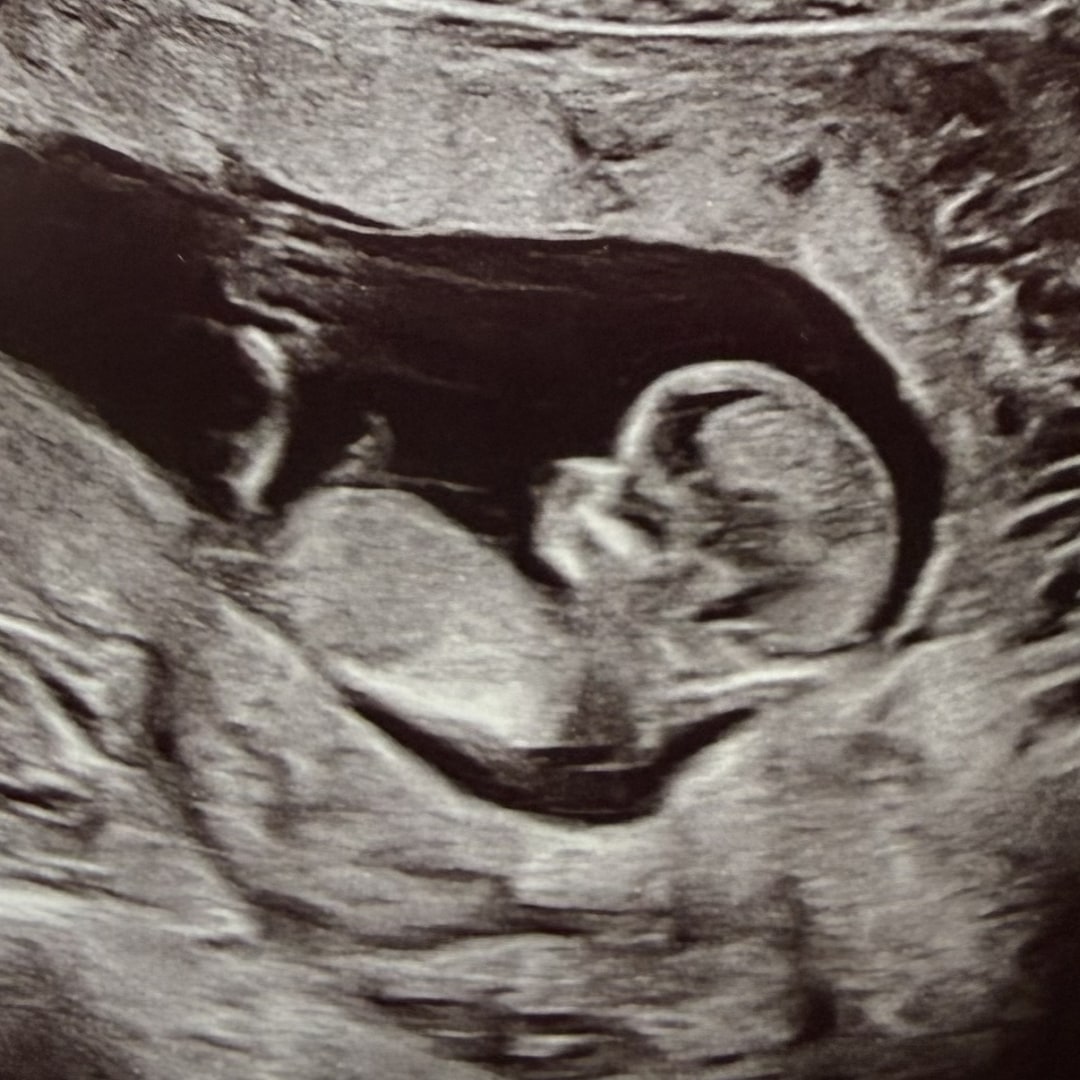 Photo shared by Melanie for their Babylist baby registry.