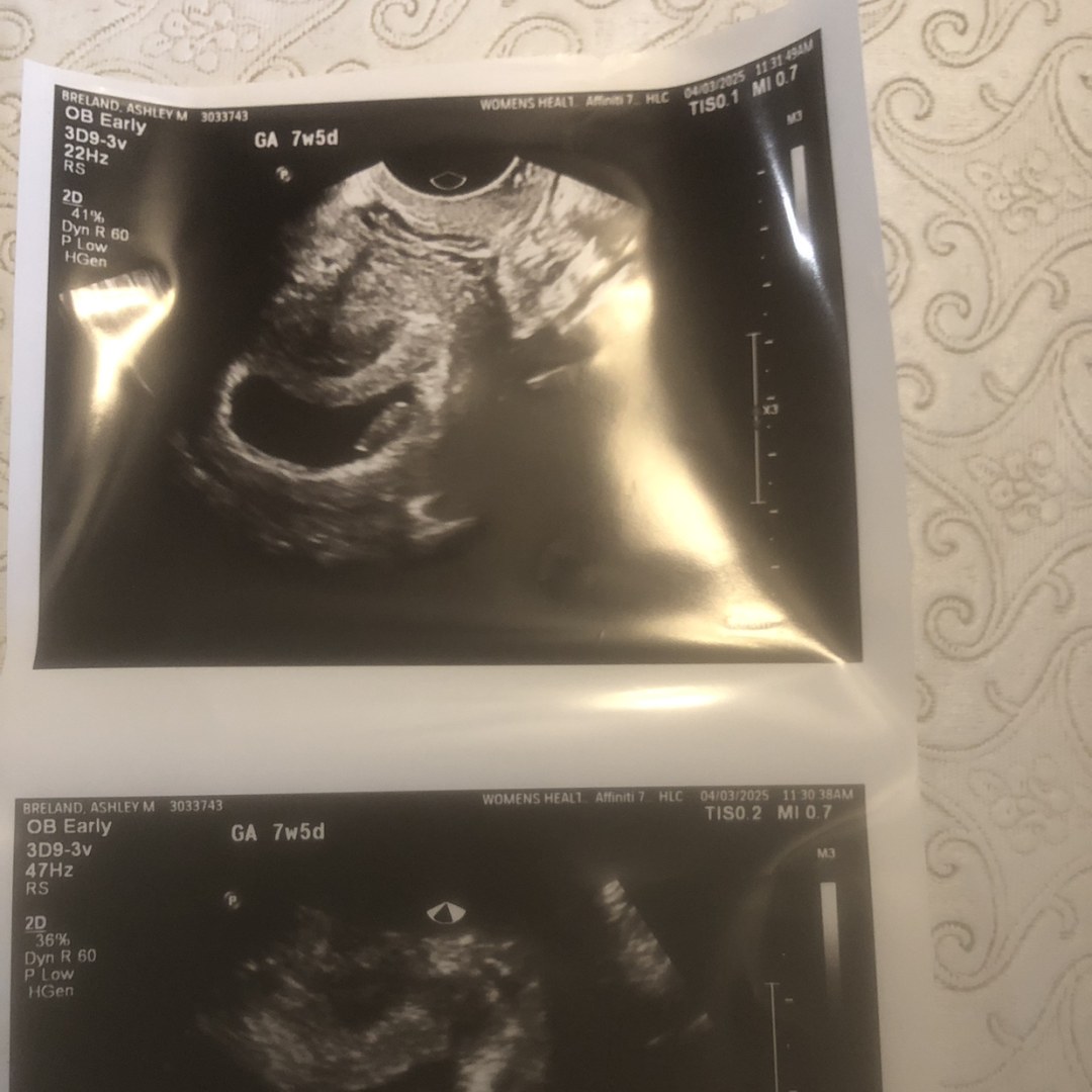 Photo shared by Ashley for their Babylist baby registry.