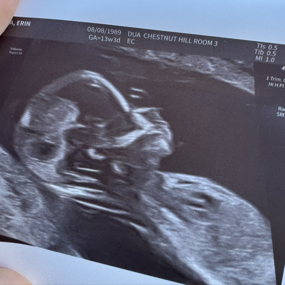 Photo shared by Erin for their Babylist baby registry.