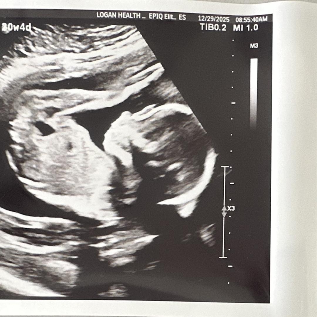 Photo shared by Erin for their Babylist baby registry.