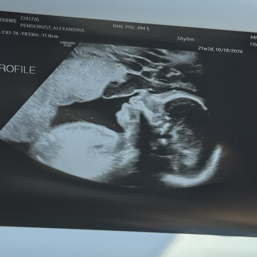 Photo shared by Alex for their Babylist baby registry.