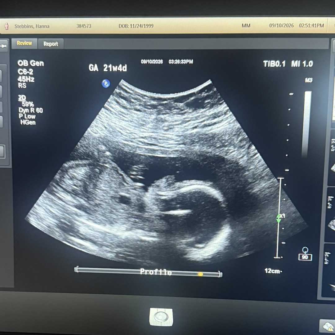 Photo shared by Hanna for their Babylist baby registry.