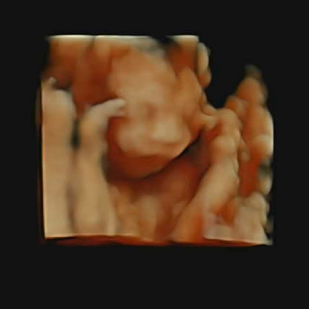 Photo shared by Victoria for their Babylist baby registry.