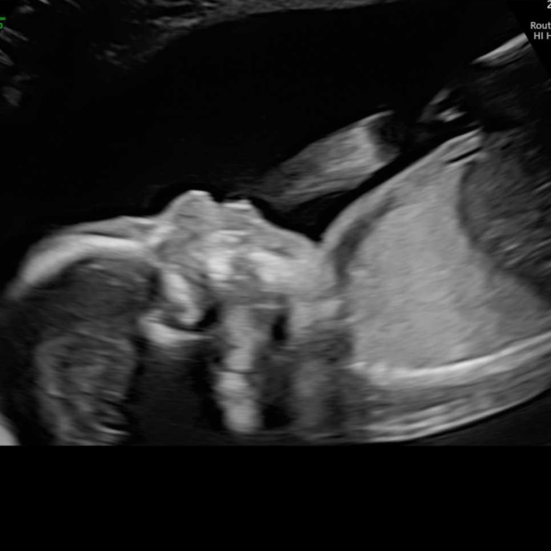 Photo shared by Haleigh for their Babylist baby registry.