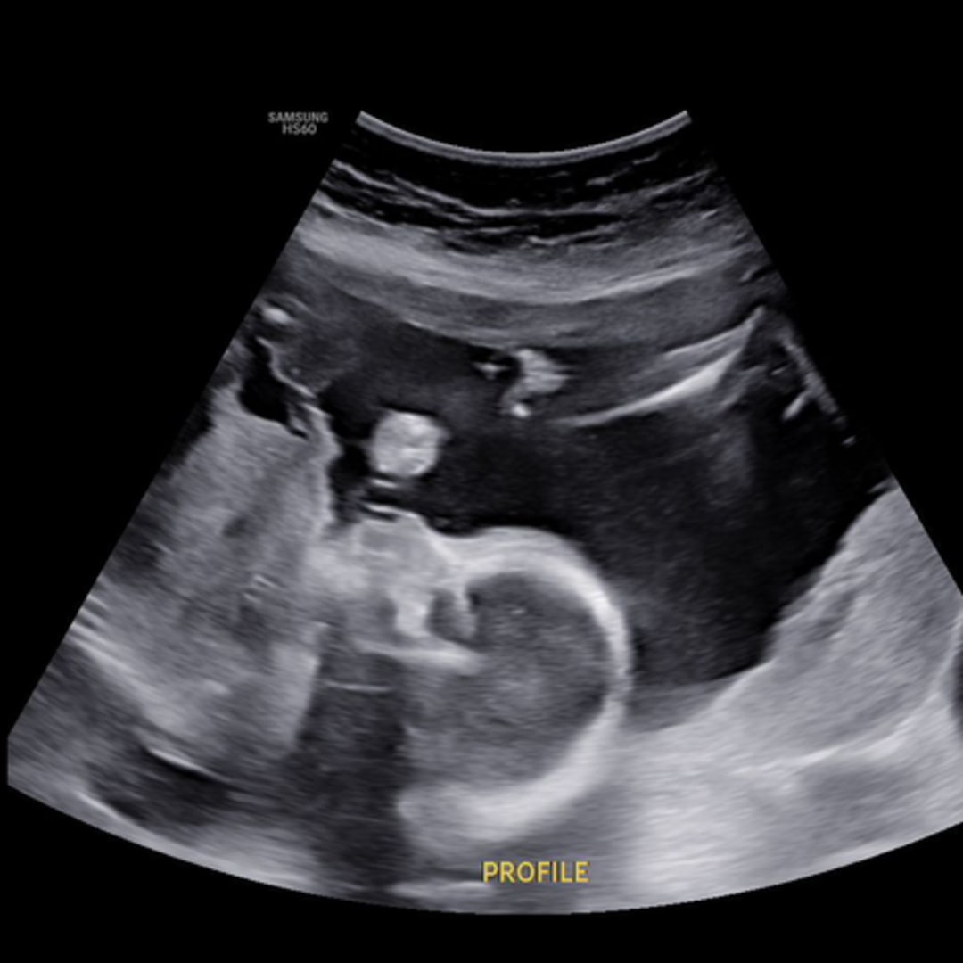 Photo shared by Rebecca for their Babylist baby registry.