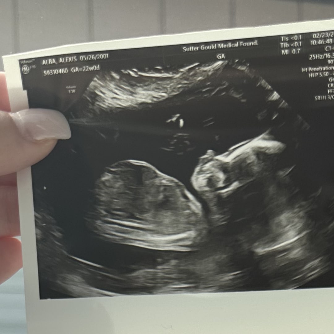 Photo shared by Alexis for their Babylist baby registry.