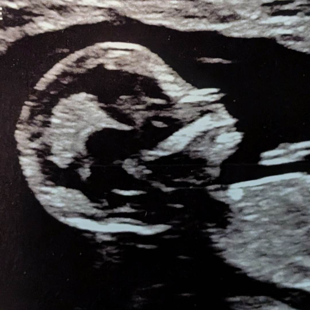 Photo shared by AUTUMN for their Babylist baby registry.