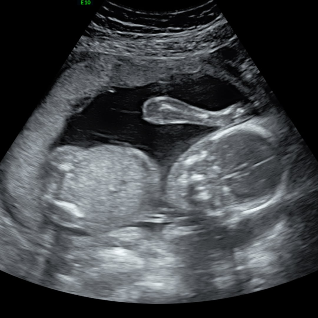 Photo shared by Lindy for their Babylist baby registry.