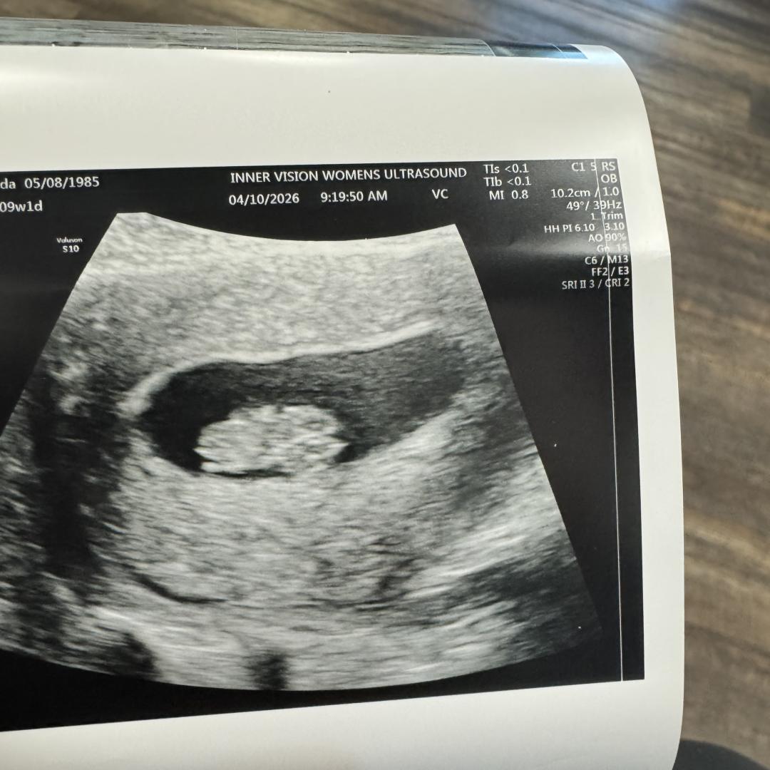 Photo shared by Tawanda for their Babylist baby registry.