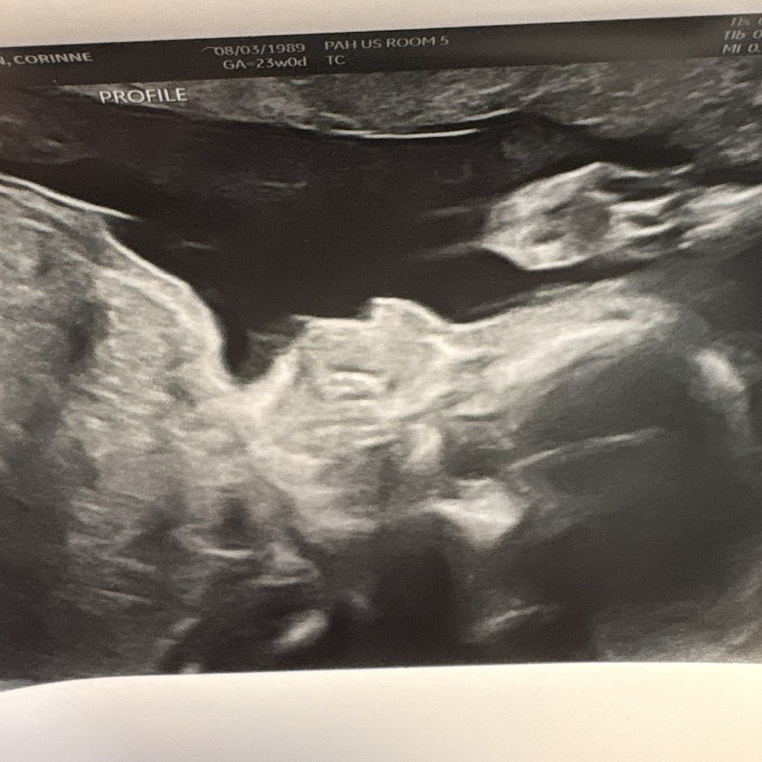 Photo shared by Corinne for their Babylist baby registry.