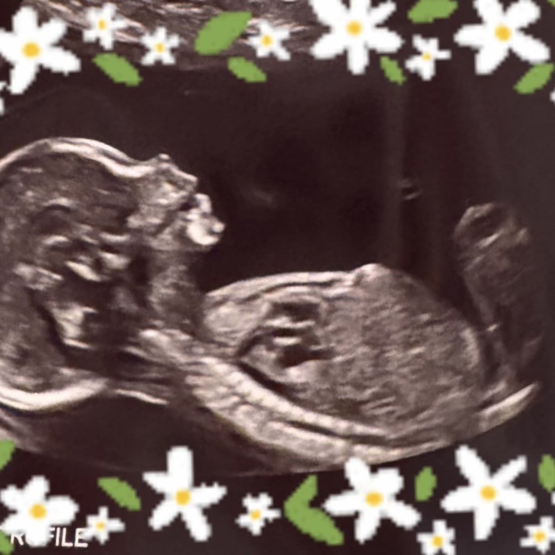 Photo shared by Abigail for their Babylist baby registry.