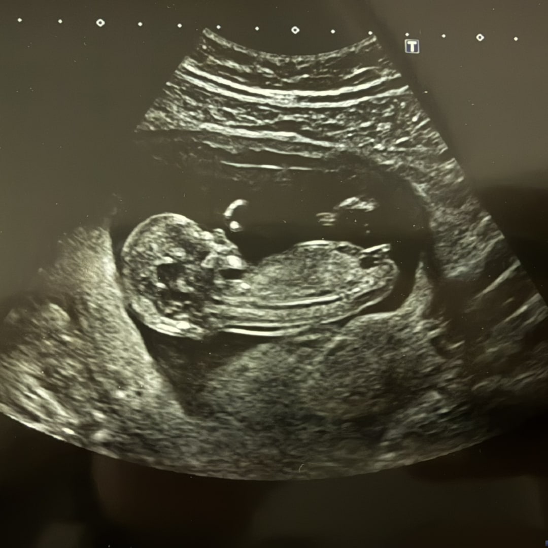 Photo shared by Kayla for their Babylist baby registry.