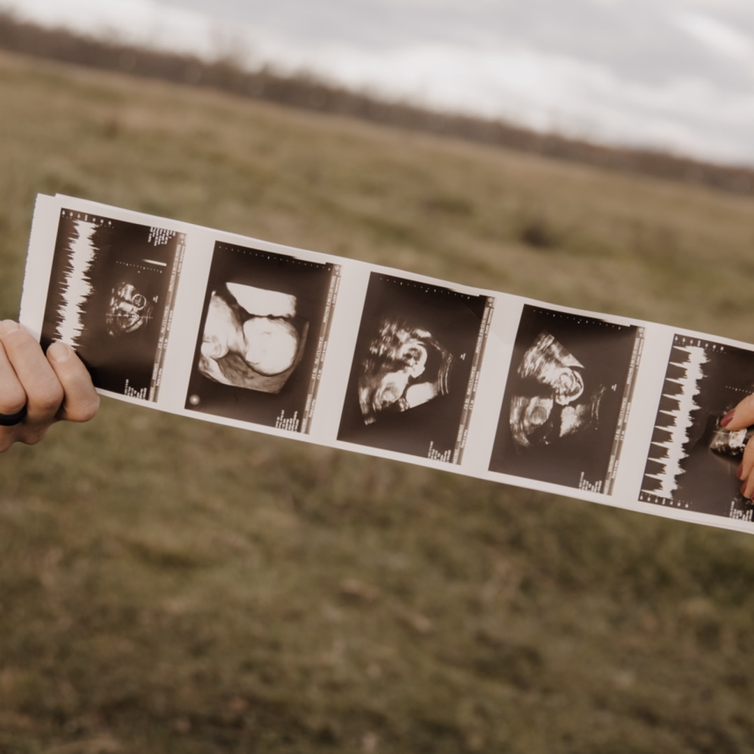 Photo shared by Sierra for their Babylist baby registry.