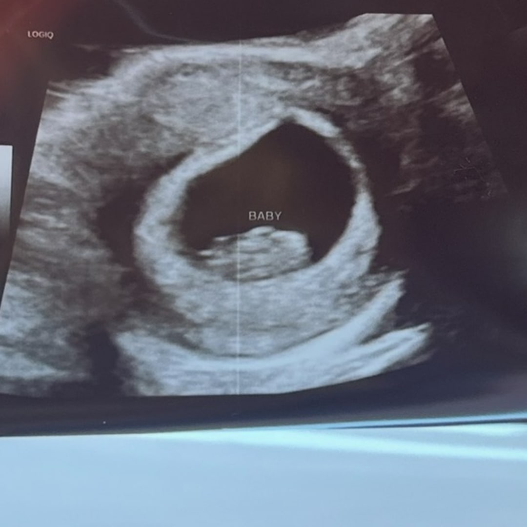 Photo shared by Ryleigh for their Babylist baby registry.