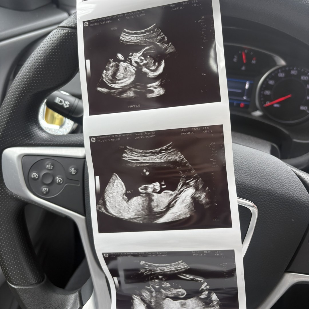 Photo shared by Cheyenne for their Babylist baby registry.