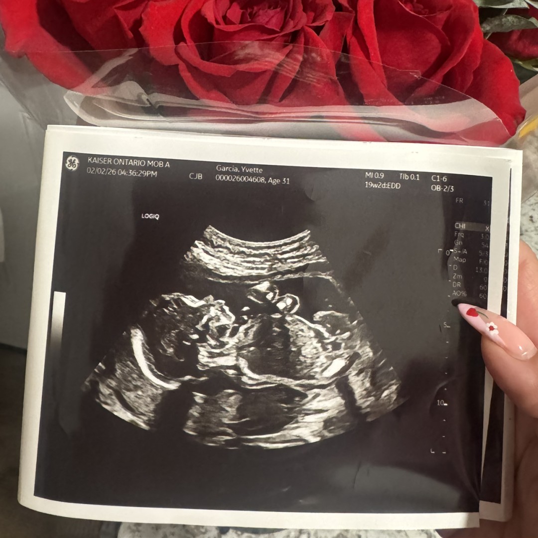 Photo shared by Yvette for their Babylist baby registry.