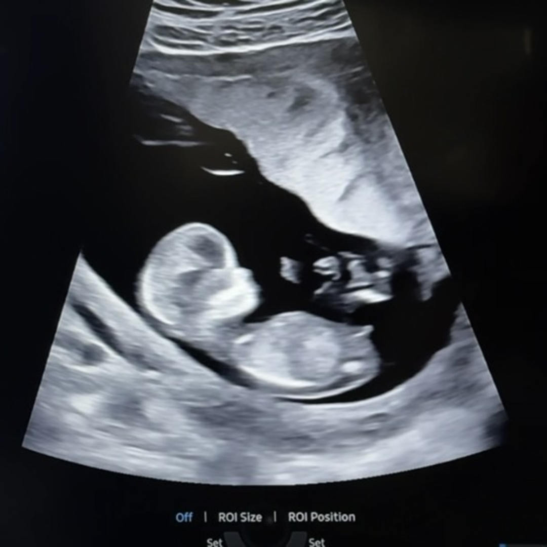 Photo shared by Alex & Miri for their Babylist baby registry.