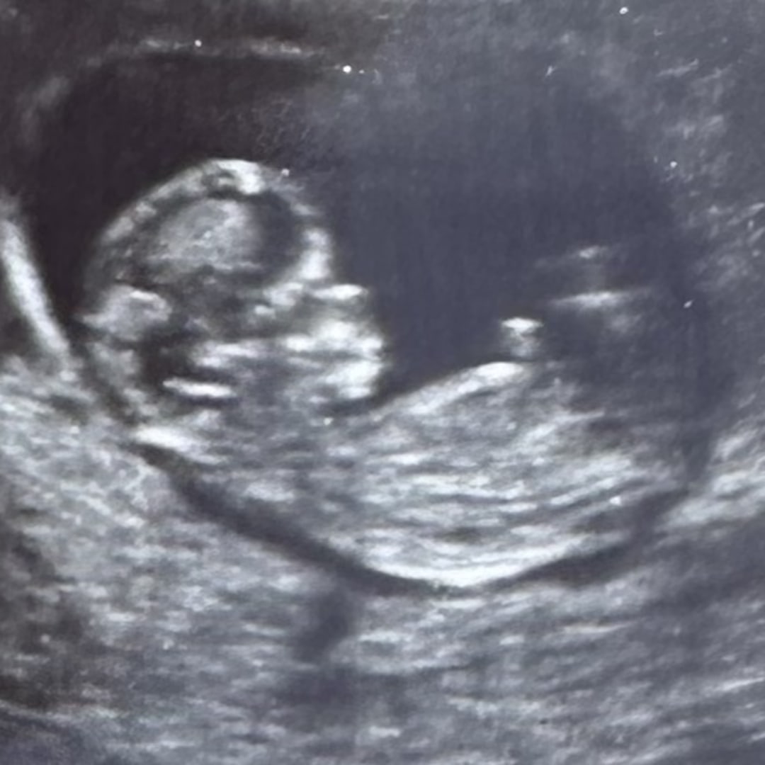 Photo shared by Dani for their Babylist baby registry.