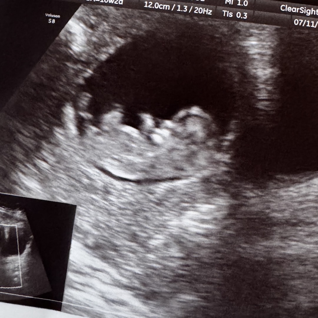 Photo shared by Harley for their Babylist baby registry.