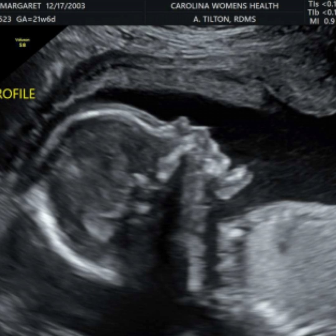 Photo shared by Olivia for their Babylist baby registry.