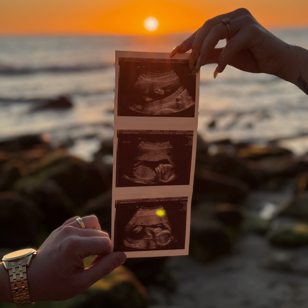 Photo shared by Savanah for their Babylist baby registry.