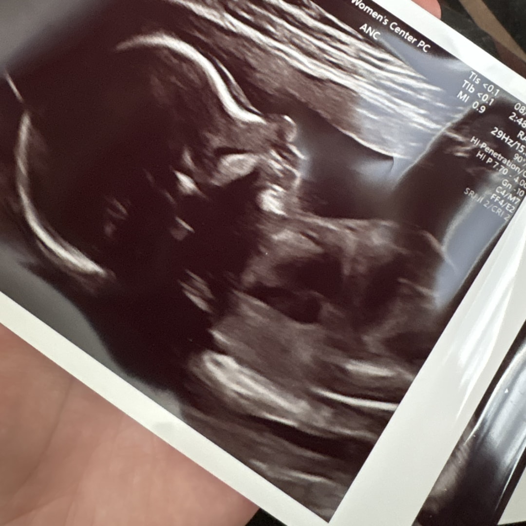 Photo shared by Olivia for their Babylist baby registry.