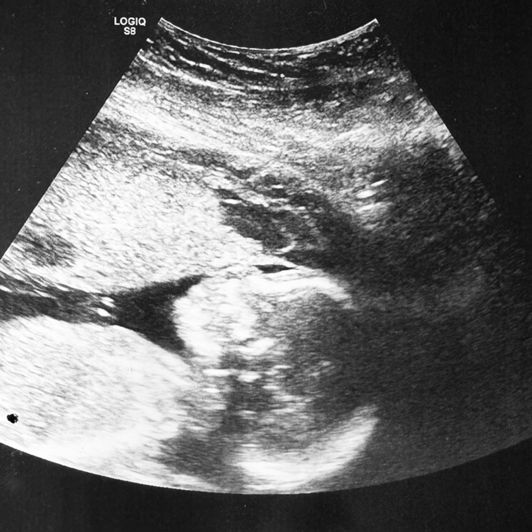 Photo shared by Madison for their Babylist baby registry.