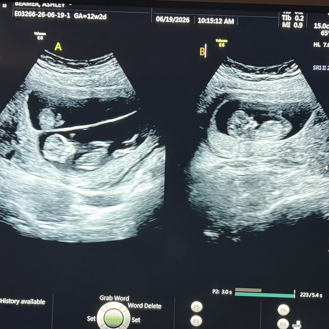 Photo shared by Ashley for their Babylist baby registry.
