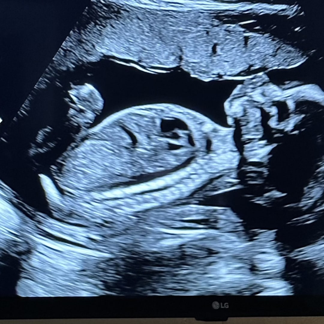 Photo shared by Tracy for their Babylist baby registry.