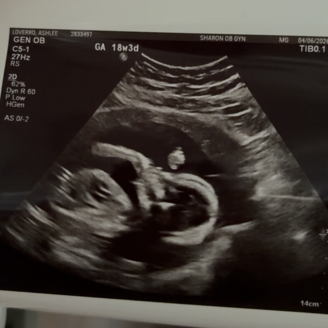 Photo shared by Ashlee for their Babylist baby registry.