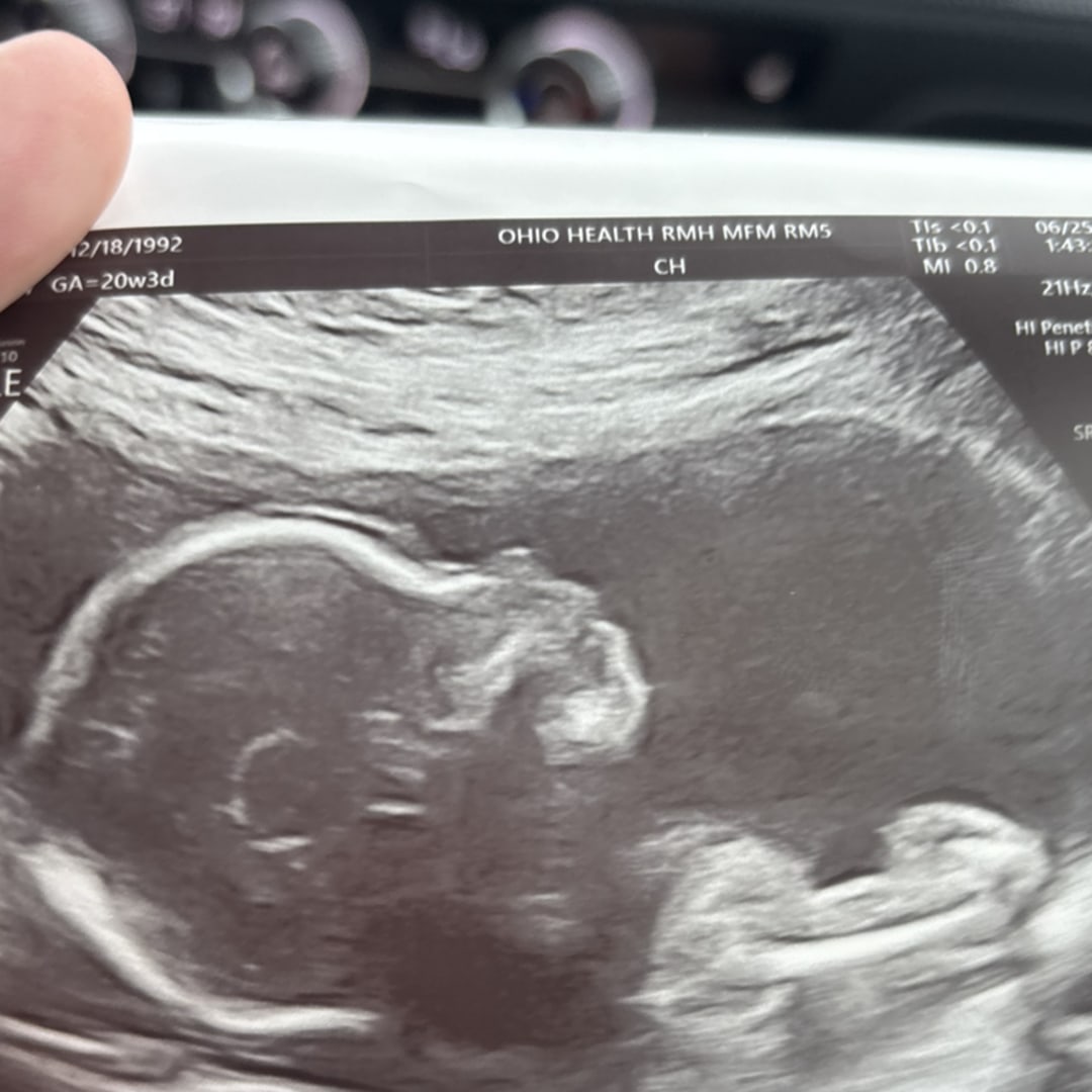 Photo shared by Kaci for their Babylist baby registry.