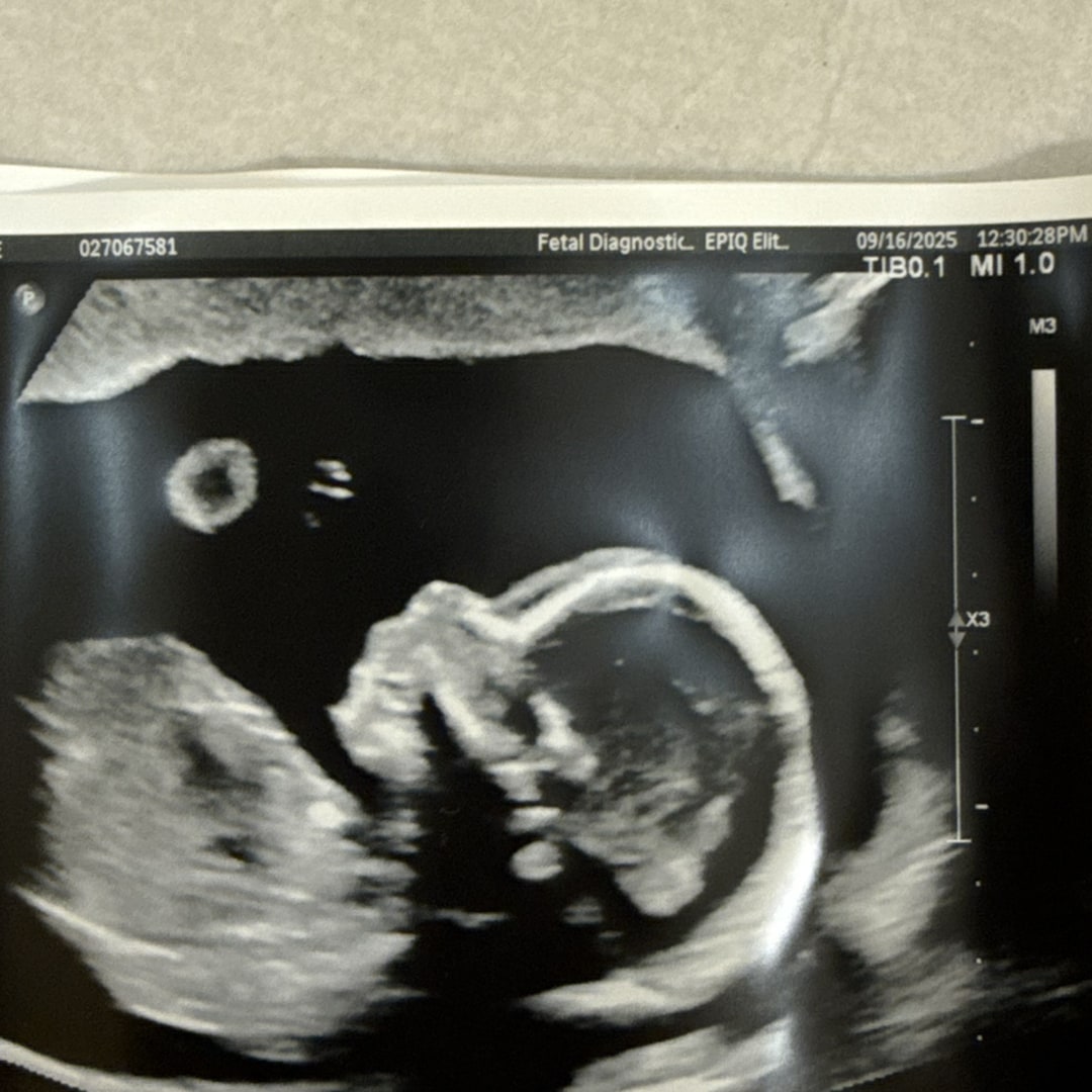 Photo shared by Petra for their Babylist baby registry.