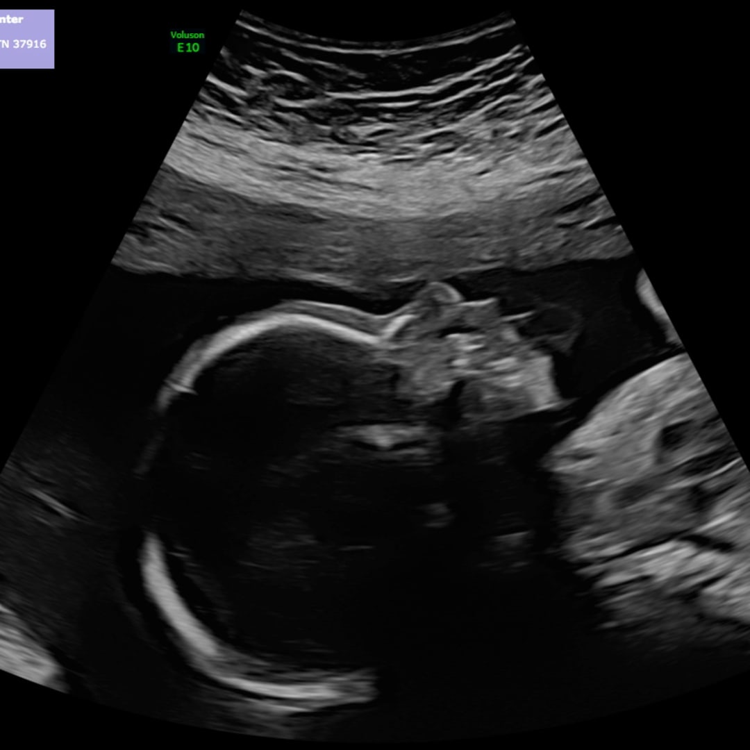 Photo shared by Jayleigh for their Babylist baby registry.