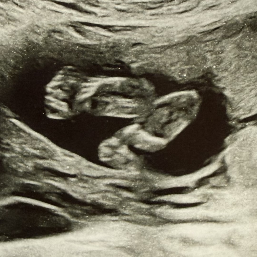 Photo shared by Rebecca for their Babylist baby registry.