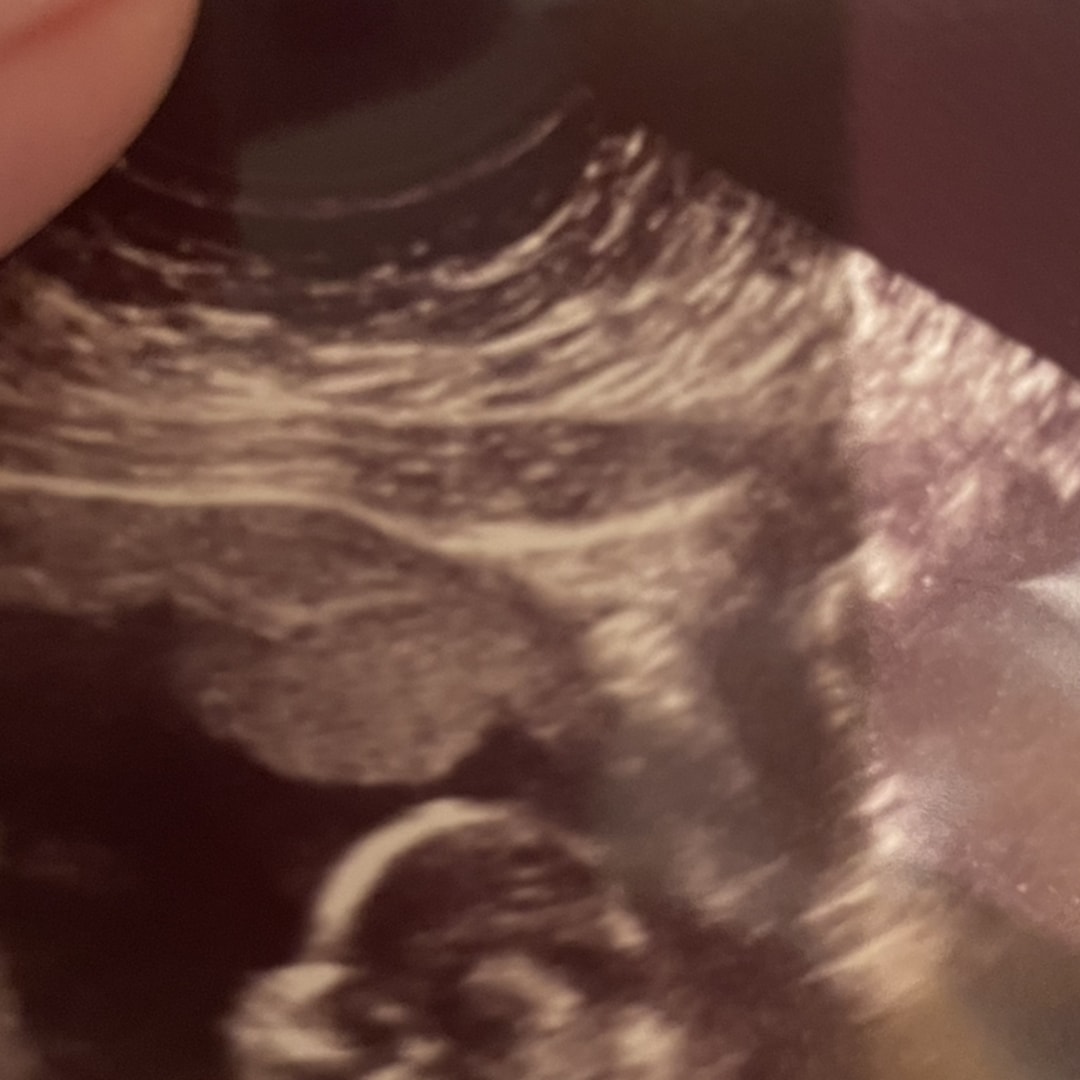 Photo shared by Samantha for their Babylist baby registry.