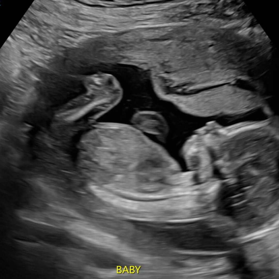 Photo shared by Iliana for their Babylist baby registry.