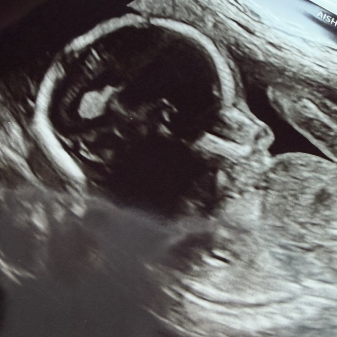 Photo shared by Cara for their Babylist baby registry.