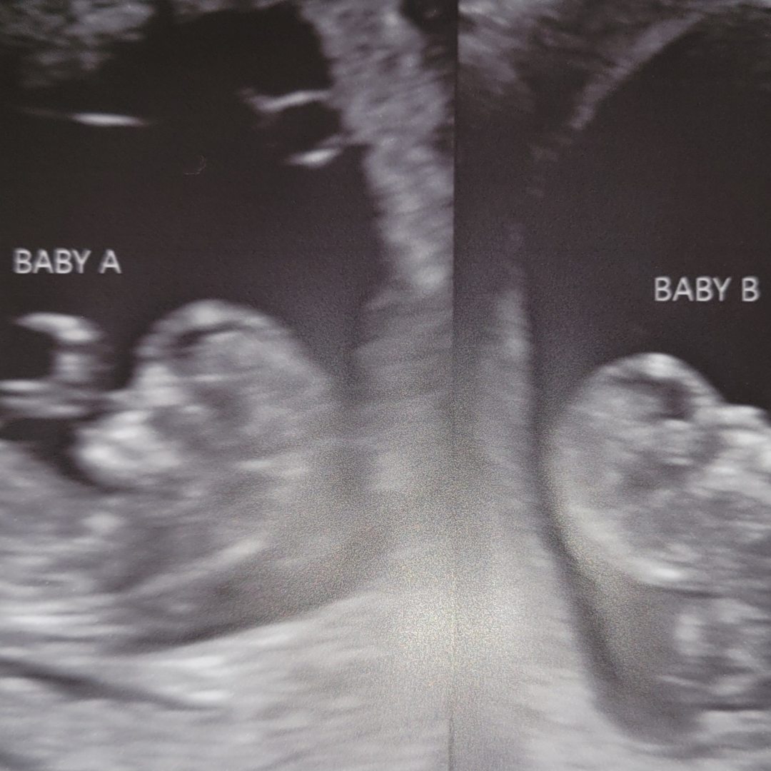 Photo shared by Jess for their Babylist baby registry.