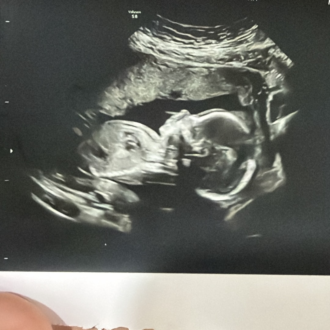 Photo shared by Emelly for their Babylist baby registry.