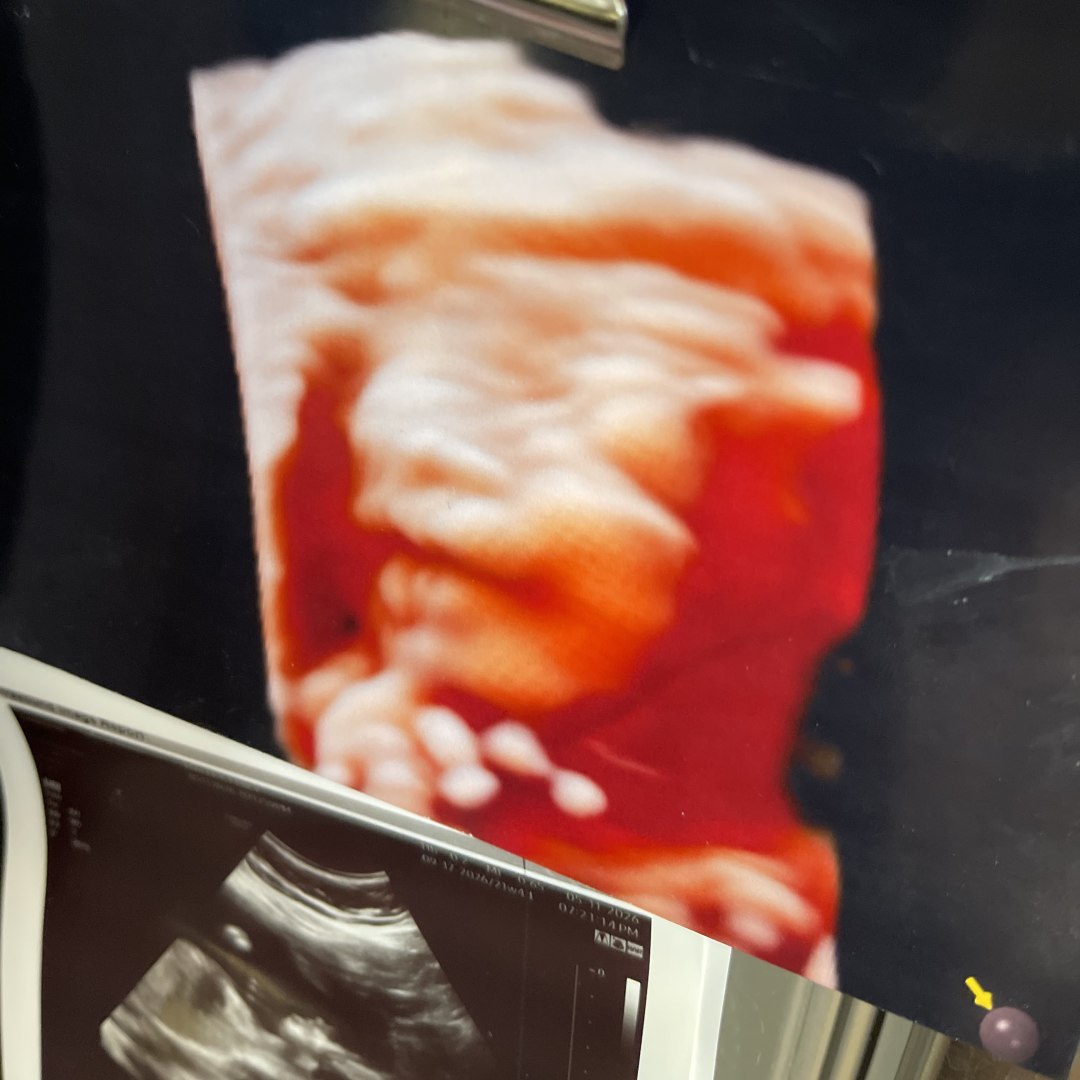 Photo shared by Emily for their Babylist baby registry.