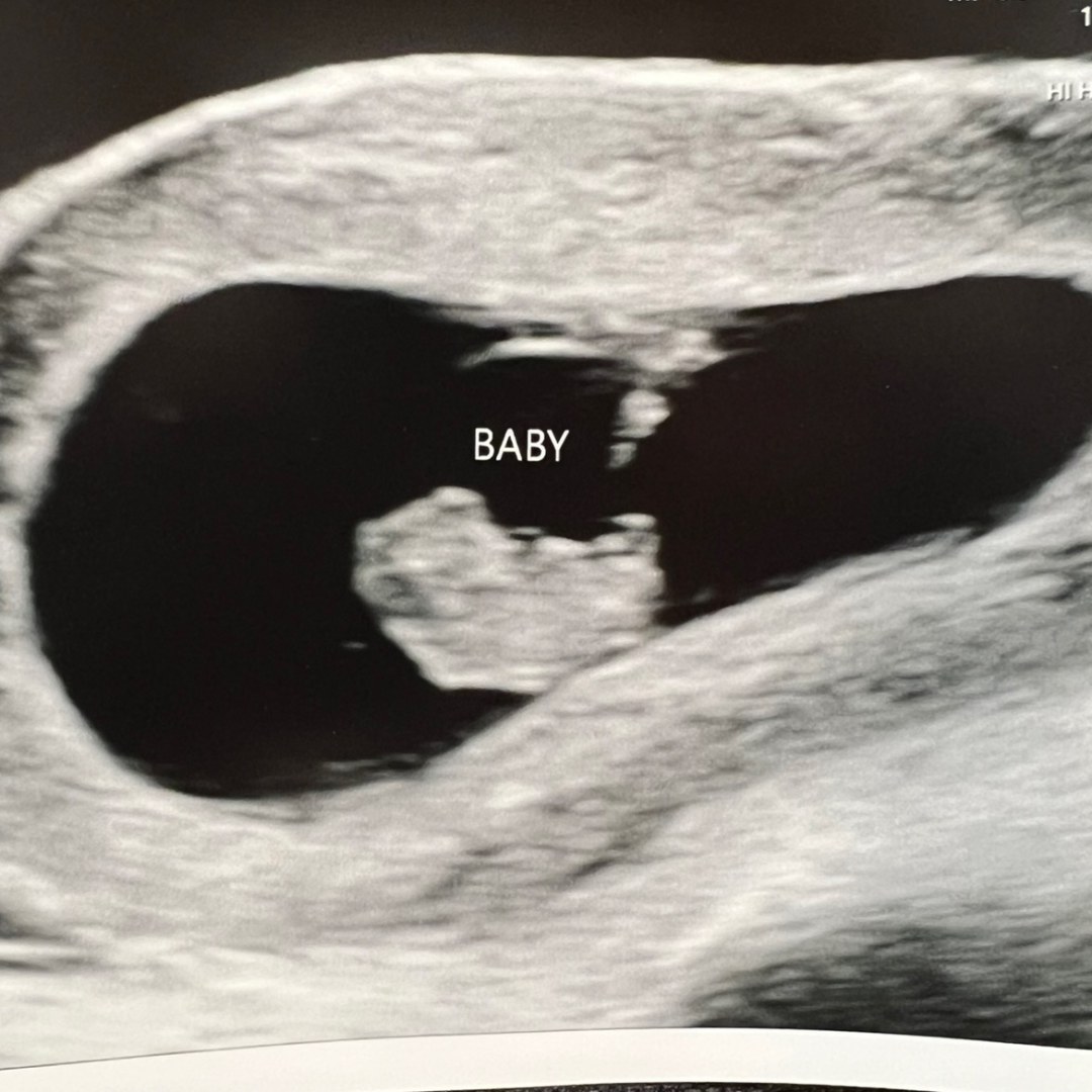 Photo shared by Chloe for their Babylist baby registry.