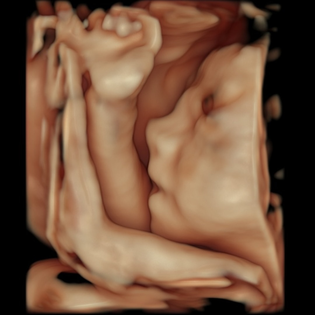Photo shared by Alyssa for their Babylist baby registry.